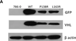 Fig.1.A showing Western Blotting from the publication: VHL-P138R and VHL-L163R Novel Variants: Mechanisms of VHL Pathogenicity Involving HIF-Dependent and HIF-Independent Actions.
