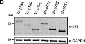 Fig.5.D showing Western Blotting in a Saccharomyces cerevisiae (Yeast) sample from the publication: The dominant-negative interplay between p53, p63 and p73: A family affair.