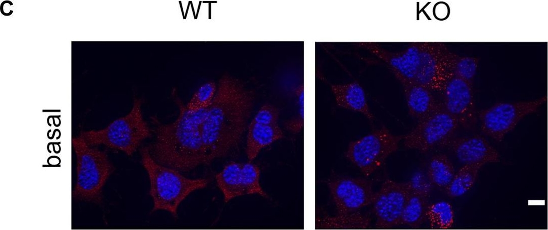 Microtubule-dependent and independent roles of spastin in lipid droplet dispersion and biogenesis.