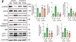 Phospho-eNOS (Ser1177) (C9C3) Rabbit Monoclonal Antibody | Cell