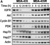 Fig.4.A showing Western Blotting in a Homo sapiens (Human) sample from the publication: Histone deacetylase activity mediates acquired resistance towards structurally diverse HSP90 inhibitors.