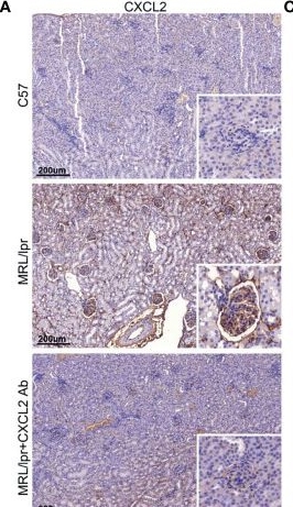 Fig.6.A showing Immunohistochemistry from the publication: Decreased miR-4512 Levels in Monocytes and Macrophages of Individuals With Systemic Lupus Erythematosus Contribute to Innate Immune Activation and Neutrsophil NETosis by Targeting TLR4 and CXCL2.
