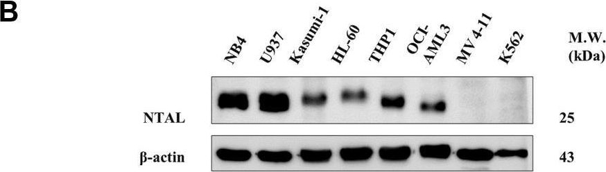 Fig.1.B showing Western Blotting from the publication: The Expression of NTAL and Its Protein Interactors Is Associated With Clinical Outcomes in Acute Myeloid Leukemia.
