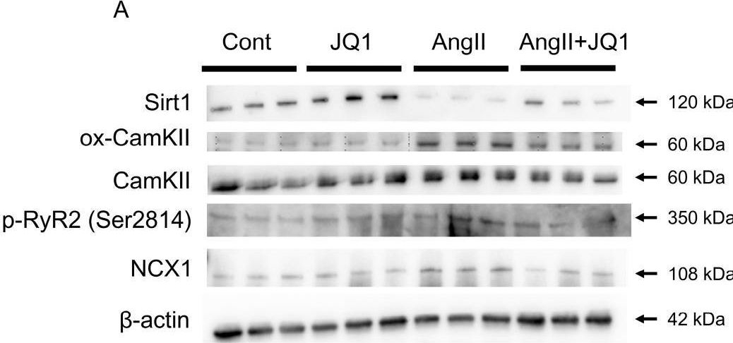 Fig.5.A showing Western Blotting from the publication: BET Inhibitor JQ1 Attenuates Atrial Fibrillation Through Modulation of Fibrosis, Calcium Homeostasis, and Mitochondrial Function in a Murine Model.