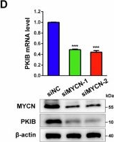 Fig.6.D showing Western Blotting from the publication: PKIB facilitates bladder cancer proliferation and metastasis through mediation of HSP27 phosphorylation by PKA.