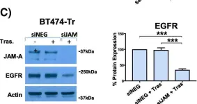 Fig.2.C showing Western Blotting from the publication: Cleavage of the extracellular domain of junctional adhesion molecule-A is associated with resistance to anti-HER2 therapies in breast cancer settings.