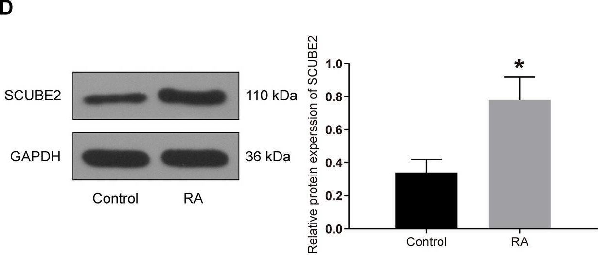 Fig.3.D showing Western Blotting in a Rattus norvegicus (Rat) sample from the publication: Knockdown of long non-coding RNA PVT1 induces apoptosis of fibroblast-like synoviocytes through modulating miR-543-dependent SCUBE2 in rheumatoid arthritis.