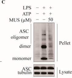 Fig.2.C showing Western Blotting in a Mus musculus (House mouse) sample from the publication: Muscone Promotes PINK1/Parkin-Associated Mitophagy to Suppress NLRP3 Inflammasome Activation: Implications for Endotoxemia Therapy.