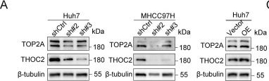 Fig.6.A showing Western Blotting in a Homo sapiens (Human) sample from the publication: Targeting THOC2-Mediated mRNA Export Induces PARP Inhibitor Vulnerability in DNA Repair-Competent Hepatocellular Carcinoma.