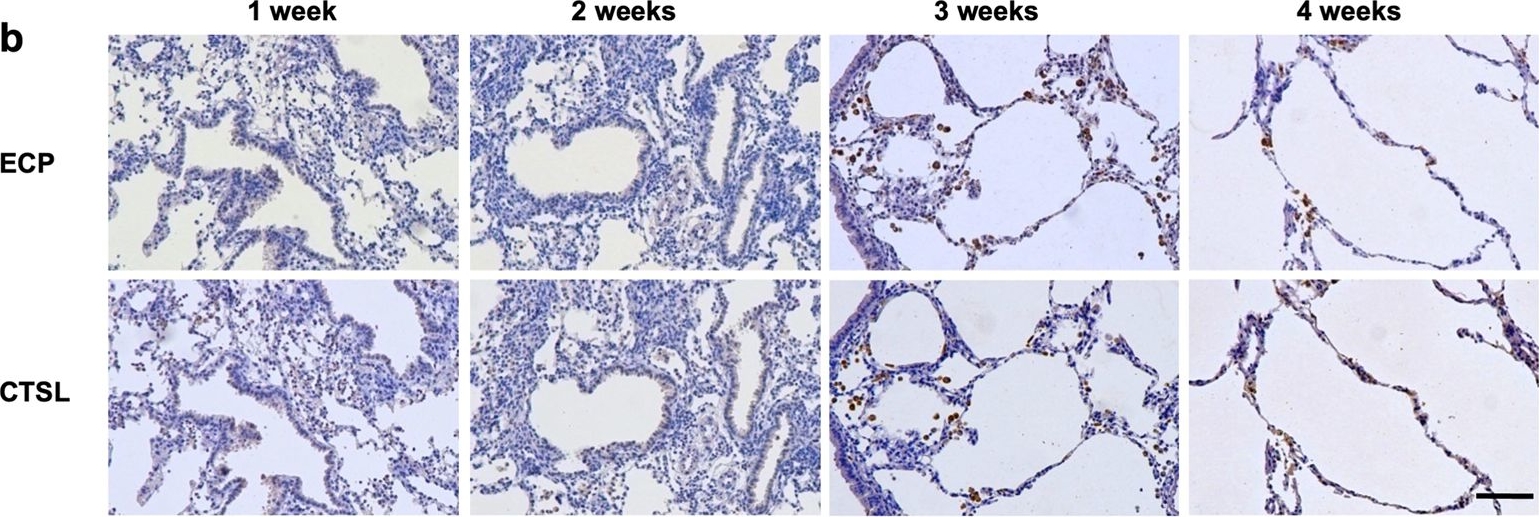 Fig.6.B showing Immunohistochemistry from the publication: Eosinophils promote pulmonary matrix destruction and emphysema via Cathepsin L.