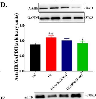 Fig.6.D showing Western Blotting from the publication: Molecular and Metabolic Mechanism of Low-Intensity Pulsed Ultrasound Improving Muscle Atrophy in Hindlimb Unloading Rats.