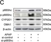 Fig.2.C showing Western Blotting from the publication: circ-CBFB upregulates p66Shc to perturb mitochondrial dynamics in APAP-induced liver injury.
