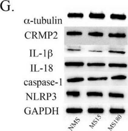 Fig.7.G showing Western Blotting in a Mus musculus (House mouse) sample from the publication: Brief Maternal Separation Promotes Resilience to Anxiety-like and Depressive-like Behaviors in Female C57BL/6J Offspring with Imiquimod-Induced Psoriasis.