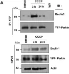 Fig.4.A showing Western Blotting in a Homo sapiens (Human) sample from the publication: SESN2 facilitates mitophagy by helping Parkin translocation through ULK1 mediated Beclin1 phosphorylation.