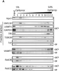 Fig.6.A showing Western Blotting from the publication: HPS1 Regulates the Maturation of Large Dense Core Vesicles and Lysozyme Secretion in Paneth Cells.