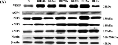 Fig.2.A showing Western Blotting from the publication: Primary blast injury-induced lesions in the retina of adult rats.