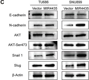 Fig.3.C showing Western Blotting from the publication: LncRNA MIR4435-2HG-mediated succinylation of USF1 promotes its protein stability and induces epithelial-mesenchymal transition in HNSCC.