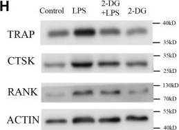 Fig.2.H showing Western Blotting in a Mus musculus (House mouse) sample from the publication: The glycolytic enzyme PKM2 regulates inflammatory osteoclastogenesis by modulating STAT3 phosphorylation.