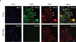 Fig.2.A showing Immunocytochemistry-immunofluorescence from the publication: BART inhibits pancreatic cancer cell invasion by PKCα inactivation through binding to ANX7.