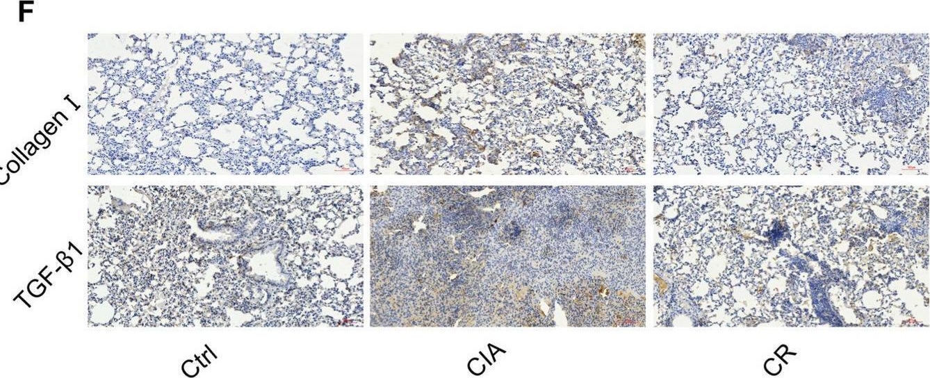 Fig.1.F showing Immunohistochemistry from the publication: Resveratrol attenuates inflammation and fibrosis in rheumatoid arthritis-associated interstitial lung disease via the AKT/TMEM175 pathway.