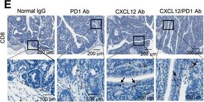 Fig.7.E showing Immunohistochemistry from the publication: Senescent Tumor Cells Build a Cytokine Shield in Colorectal Cancer.
