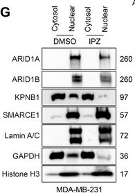 Fig.6.G showing Western Blotting in a Homo sapiens (Human) sample from the publication: Disruption of ARID1B Recruitment to the Nuclear Pore Complex as a New Anticancer Therapeutic Strategy.