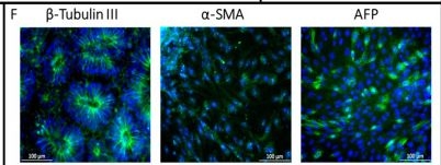 Fig.2.F showing Immunohistochemistry-immunofluorescence in a Homo sapiens (Human) sample from the publication: Generation and Characterization of a Human-Derived and Induced Pluripotent Stem Cell (iPSC) Line from an Alzheimer's Disease Patient with Neuropsychiatric Symptoms.