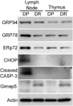 Fig.1.A showing Western Blotting in a Rattus norvegicus (Rat) sample from the publication: CHOP mediates endoplasmic reticulum stress-induced apoptosis in Gimap5-deficient T cells.