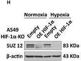 Fig.1.H showing Western Blotting from the publication: The Interplay Between HIF-1α and EZH2 in Lung Cancer and Dual-Targeted Drug Therapy.
