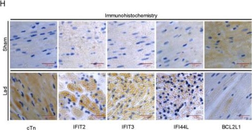 Fig.4.H showing Immunohistochemistry from the publication: Identified Three Interferon Induced Proteins as Novel Biomarkers of Human Ischemic Cardiomyopathy.
