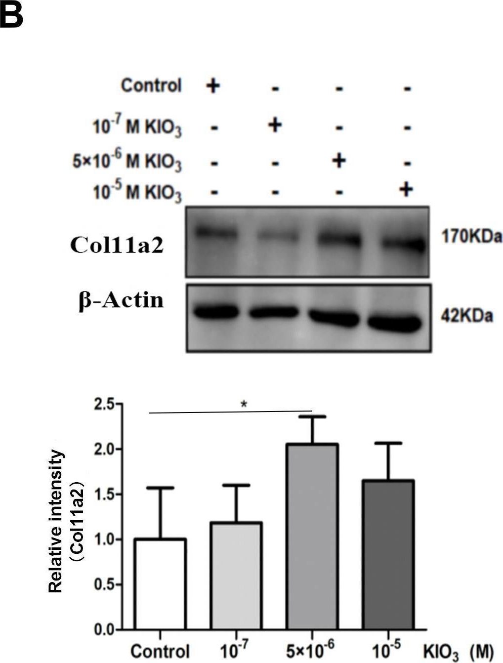 Fig.5.B showing Western Blotting from the publication: A new LNC89/LNC60-Col11a2 axis revealed by whole-transcriptome analysis may be associated with goiters related to excess iodine nutrition.
