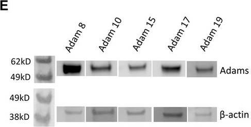 Fig.6.E showing Western Blotting in a HIV sample from the publication: Inhibition of HIV-1 release by ADAM metalloproteinase inhibitors.