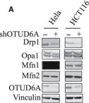 Fig.2.A showing Western Blotting from the publication: Deubiquitinase OTUD6A promotes proliferation of cancer cells via regulating Drp1 stability and mitochondrial fission.