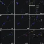 Fig.4.A showing Immunocytochemistry-immunofluorescence from the publication: Human ClC-6 is a late endosomal glycoprotein that associates with detergent-resistant lipid domains.