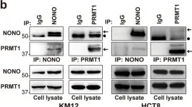 Fig.3.B showing Western Blotting from the publication: PRMT1 enhances oncogenic arginine methylation of NONO in colorectal cancer.