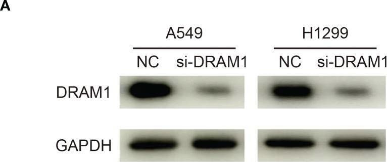 Fig.9.A showing Western Blotting from the publication: The Comprehensive Analysis Identified an Autophagy Signature for the Prognosis and the Immunotherapy Efficiency Prediction in Lung Adenocarcinoma.