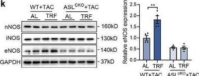 Fig.6.K showing Western Blotting in a Mus musculus (House mouse) sample from the publication: Cardiac Urea Cycle Activation by Time-Restricted Feeding Protects Against Pressure Overload-Induced Heart Failure.