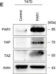 Fig.4.E showing Western Blotting from the publication: Twist-mediated PAR1 induction is required for breast cancer progression and metastasis by inhibiting Hippo pathway.