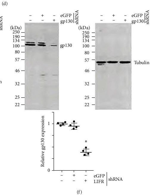 Fig.4.D showing Western Blotting from the publication: Empagliflozin Reverses Oxidized LDL-Induced RECK Suppression, Cardiotrophin-1 Expression, MMP Activation, and Human Aortic Smooth Muscle Cell Proliferation and Migration.