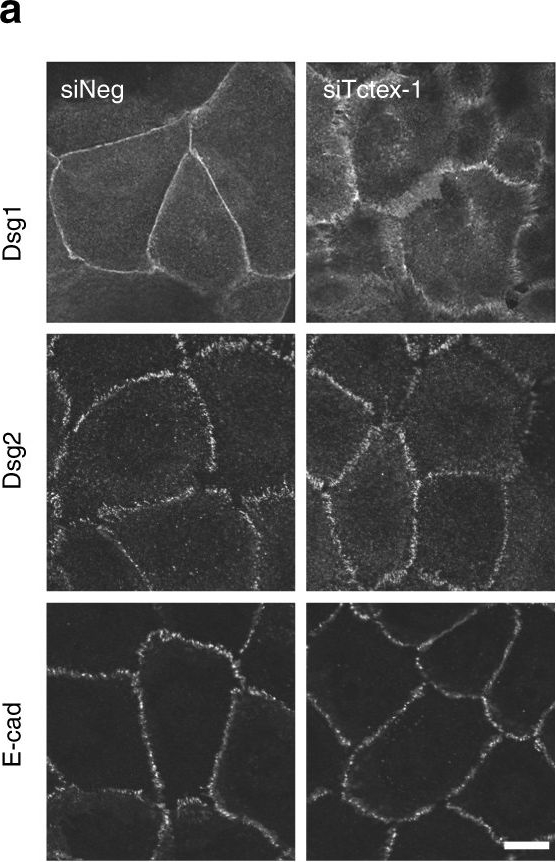 Desmosomal cadherin association with Tctex-1 and cortactin-Arp2/3 drives perijunctional actin polymerization to promote keratinocyte delamination.