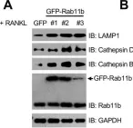 Fig.6.A showing Western Blotting in a Mus musculus (House mouse) sample from the publication: The Inhibitory Role of Rab11b in Osteoclastogenesis through Triggering Lysosome-Induced Degradation of c-Fms and RANK Surface Receptors.
