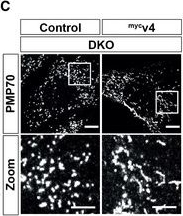 Fig.5.C showing Immunocytochemistry-immunofluorescence in a Mus musculus (House mouse) sample from the publication: Peroxisomal fission is modulated by the mitochondrial Rho-GTPases, Miro1 and Miro2.