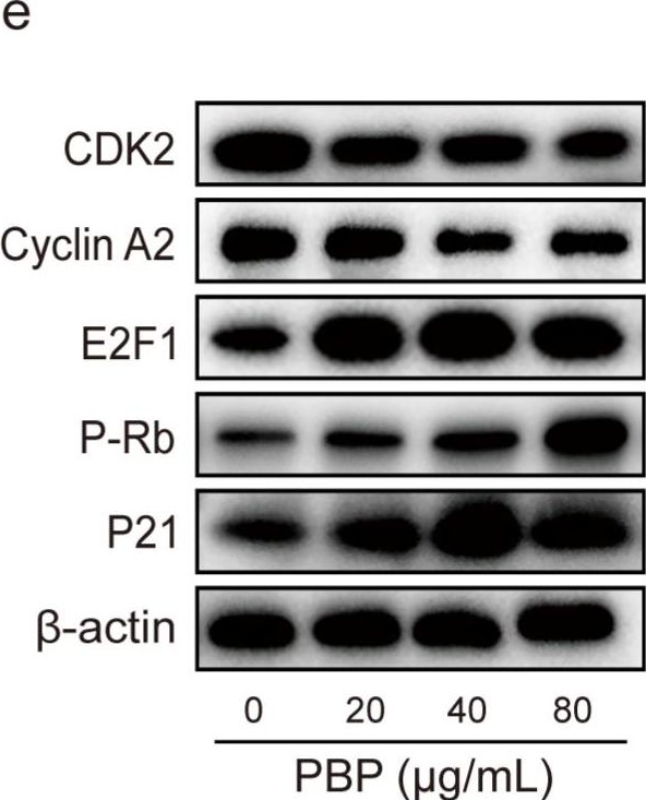 Fig.7.E showing Western Blotting in a Homo sapiens (Human) sample from the publication: Phellinus baumii Polyphenol: A Potential Therapeutic Candidate against Lung Cancer Cells.