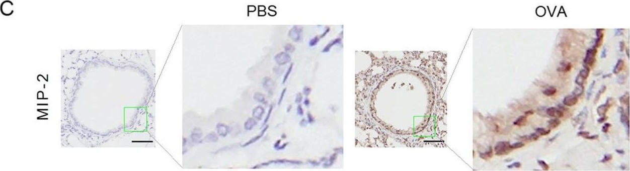 Fig.1.C showing Immunohistochemistry in a Mus musculus (House mouse) sample from the publication: Thrombin induces IL-8/CXCL8 expression by DCLK1-dependent RhoA and YAP activation in human lung epithelial cells.