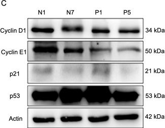 Fig.4.C showing Western Blotting from the publication: Pathophysiology of androgen-associated endothelial cell dysfunction in phenotype A polycystic ovarian syndrome revealed by iPSCs modeling.