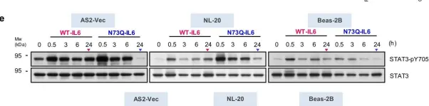 Fig.2.E showing Western Blotting in a Homo sapiens (Human) sample from the publication: Defective N-glycosylation of IL6 induces metastasis and tyrosine kinase inhibitor resistance in lung cancer.