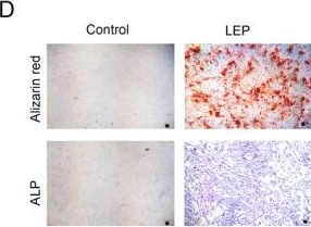 Fig.2.D showing Immunohistochemistry from the publication: Leptin Regulates Intervertebral Disc Calcification and Ossification by Promoting Glycolysis Through OCN/HIF-1α Axis.