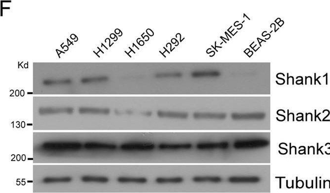Fig.1.F showing Western Blotting in a Homo sapiens (Human) sample from the publication: SHANK1 facilitates non-small cell lung cancer processes through modulating the ubiquitination of Klotho by interacting with MDM2.