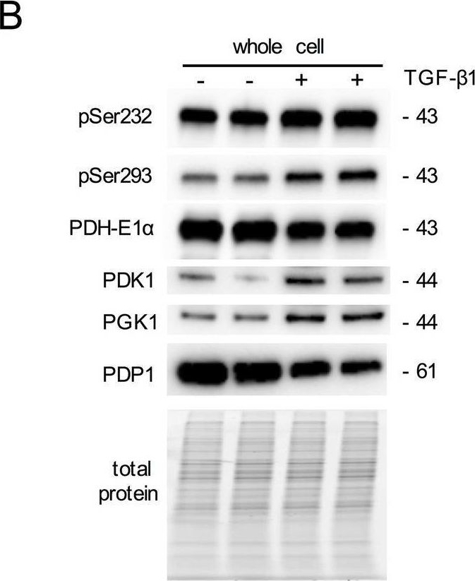 Fig.2.B showing Western Blotting from the publication: TGF-β1 is a regulator of the pyruvate dehydrogenase complex in fibroblasts.