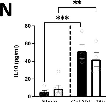 Fig.6.N showing Enzyme-linked immunosorbent assay from the publication: Galectin-3/CD146 interaction promotes renal damage and systemic inflammation after acute kidney injury.